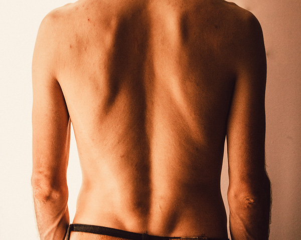 Bulging Disk Pain Doesn’t Just Happen in Your Lower Back